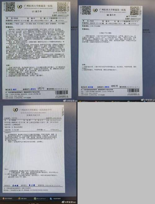 汽车维修保养诊断报告解读：让爱车健康行驶